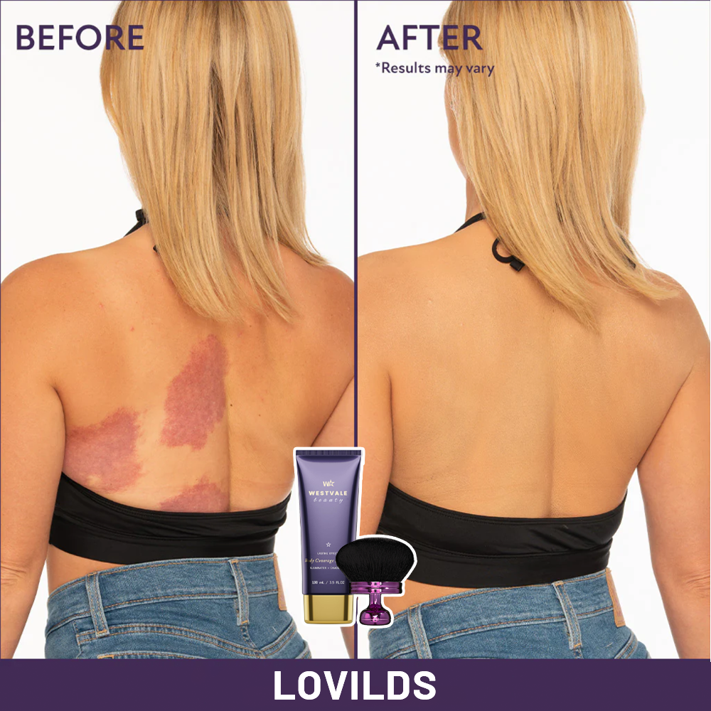 Final 3 Hours 70% OFF 1:Beauty Body Coverage Perfector with Brush